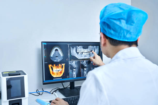 Best Emergency Dental Extractions in Dansville, NY